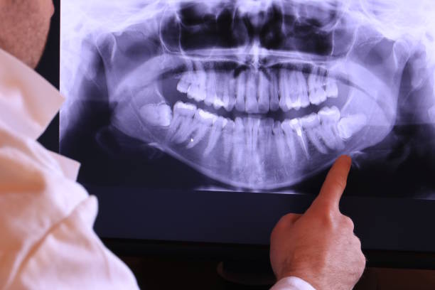Best Knocked-Out Tooth Emergency  in Lincoln, AR